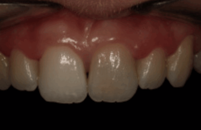Before