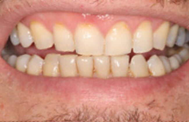 After