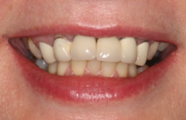 Before