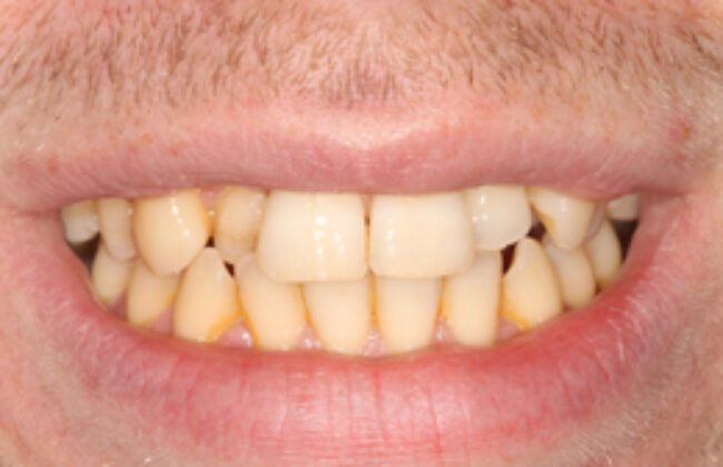 Before