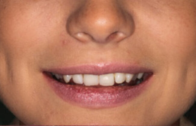 Before