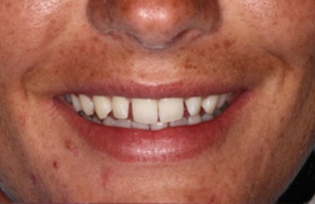Before