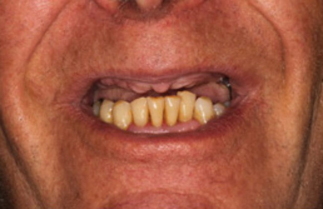 Before