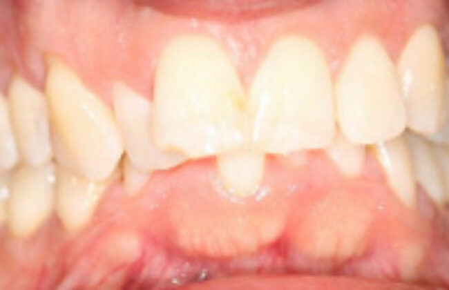 Before