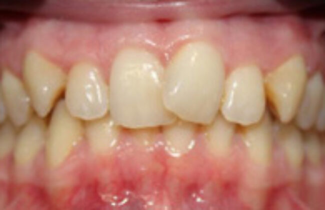 Before