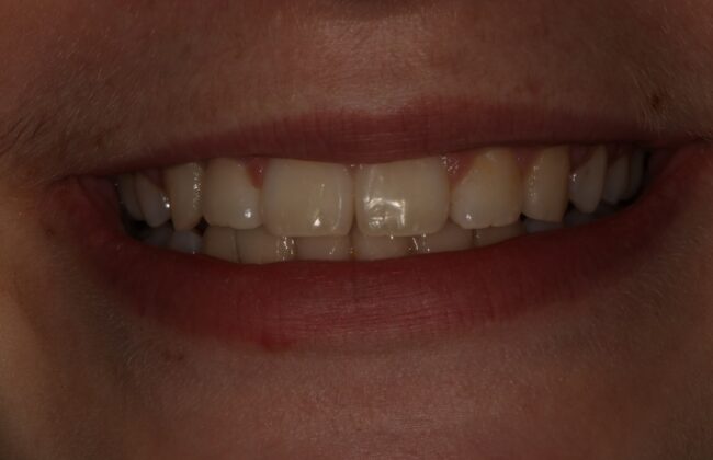 After
