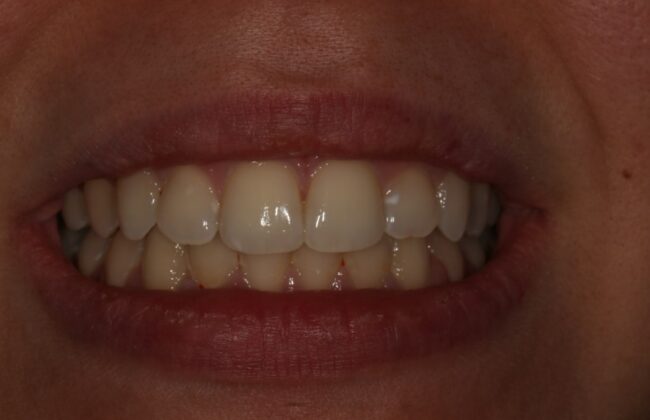After