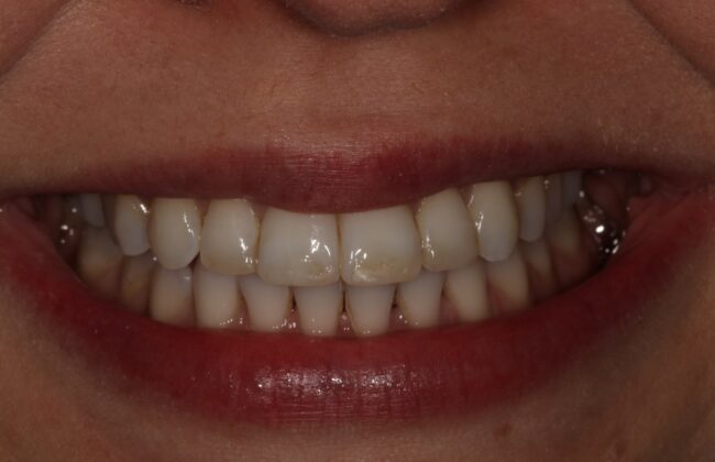 After