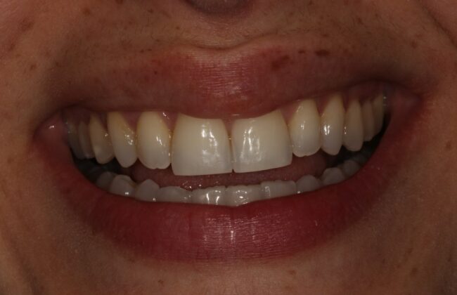 After