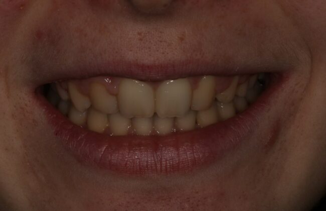 After