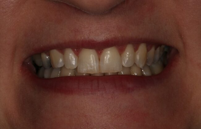 After