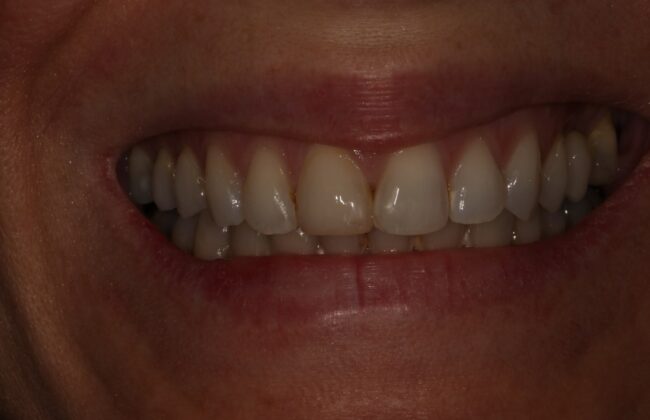 After
