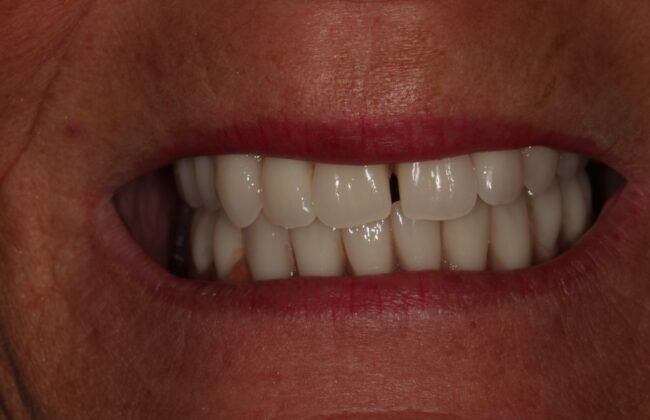 After