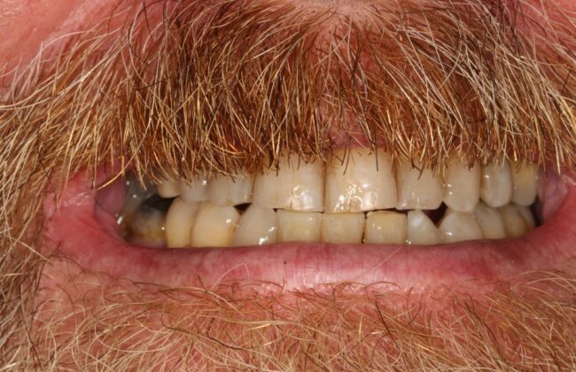 After
