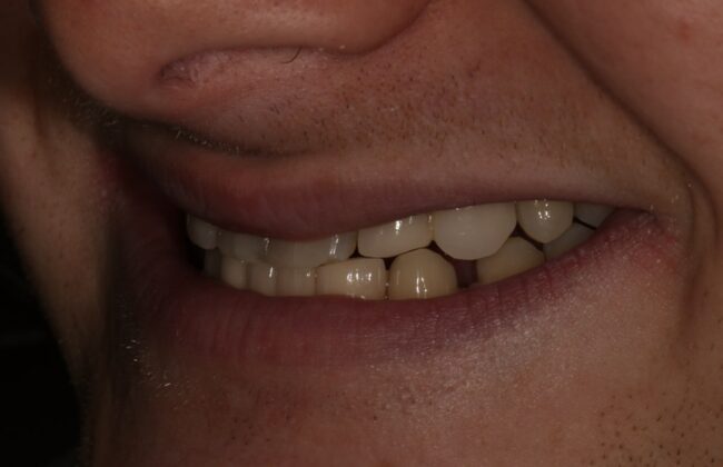 After