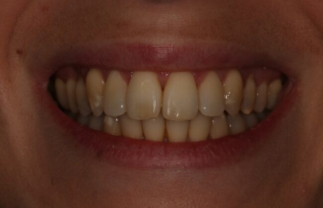 After