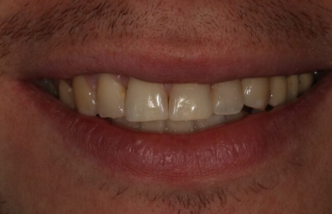 After