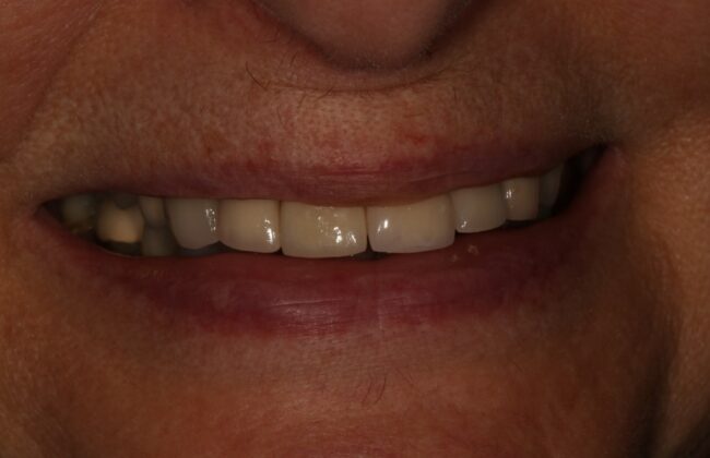 After
