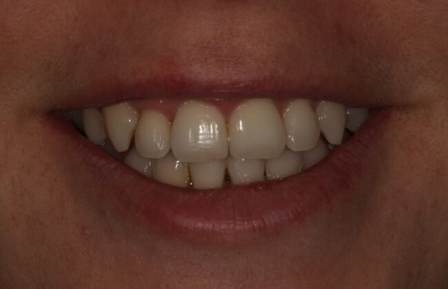 After