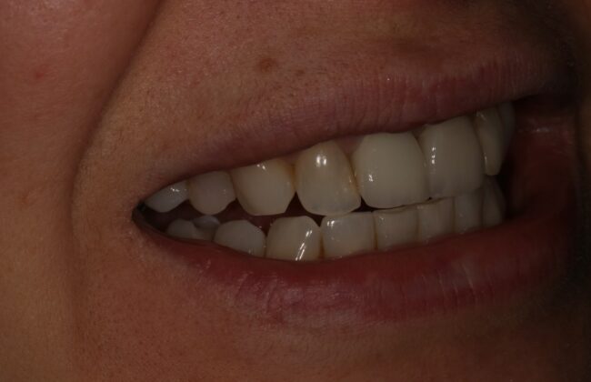 After