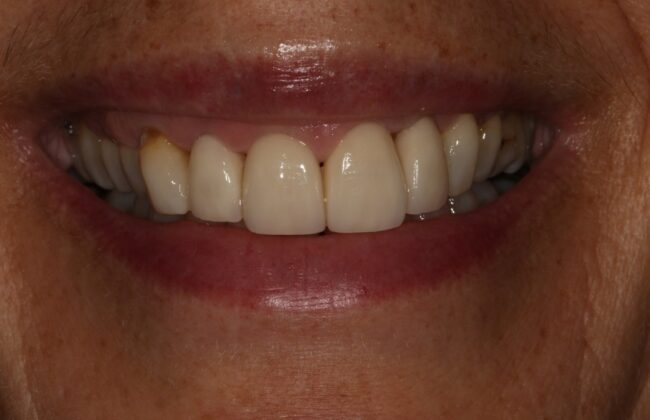 After