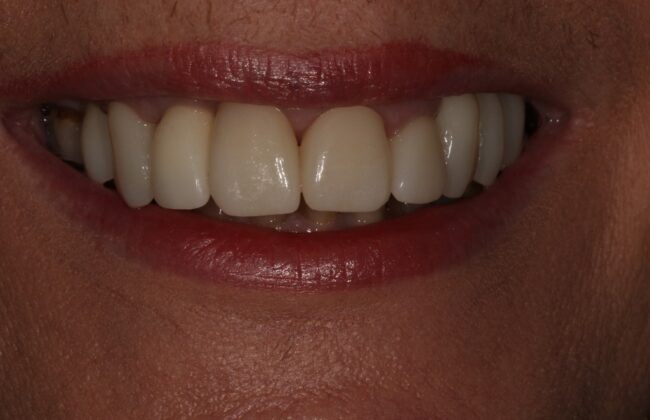 After