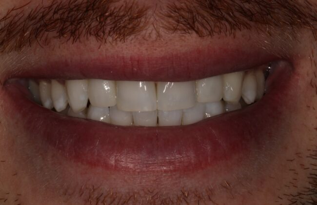 After