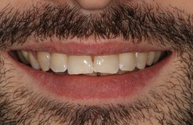 After