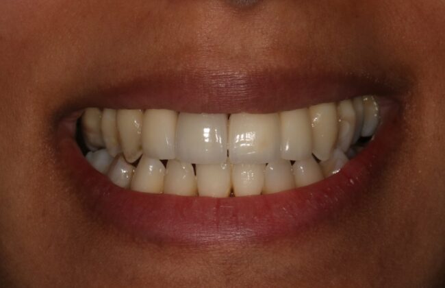 After