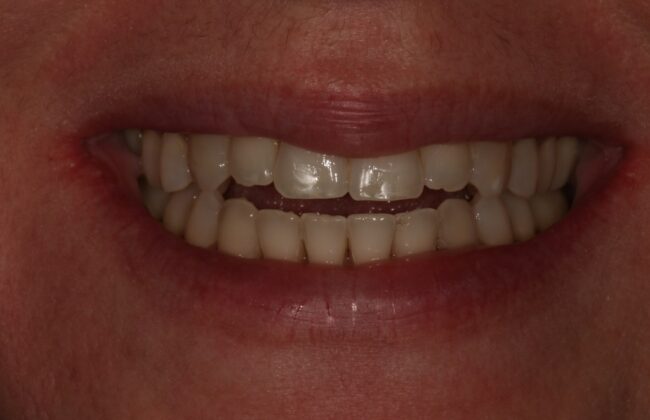After