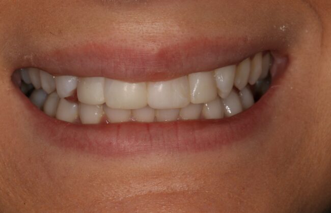 After