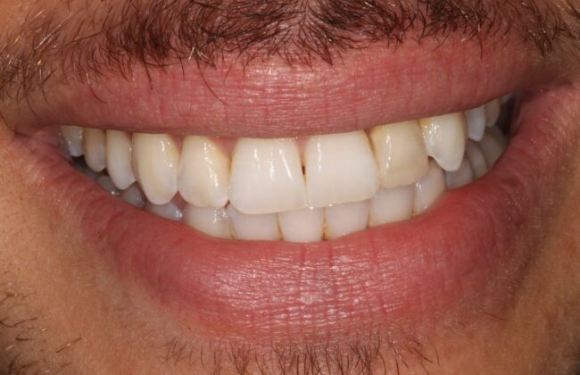 After