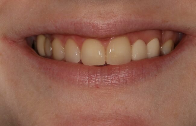 After