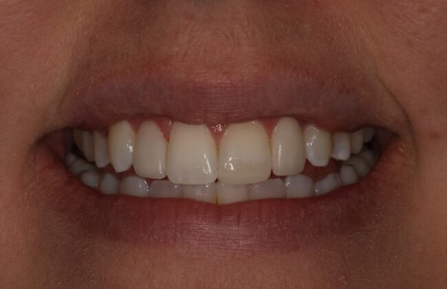 After