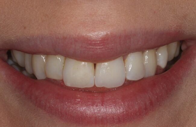 After