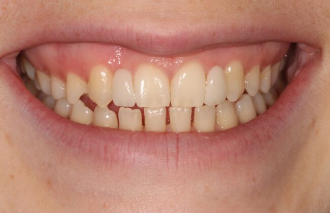 After