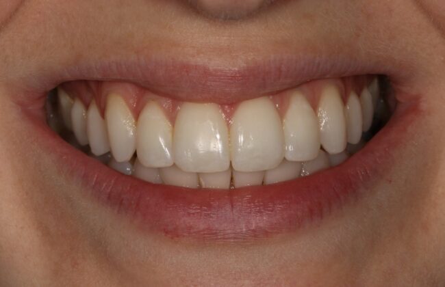 After