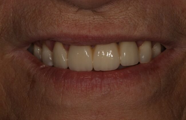 After
