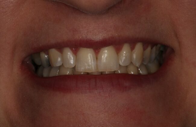 After