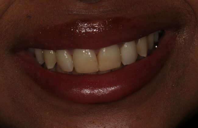 After