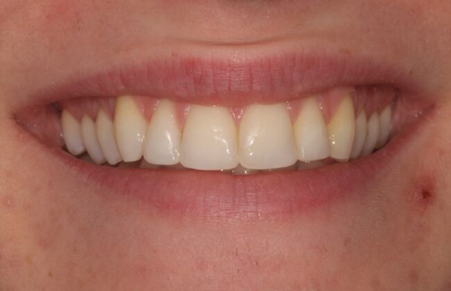 After