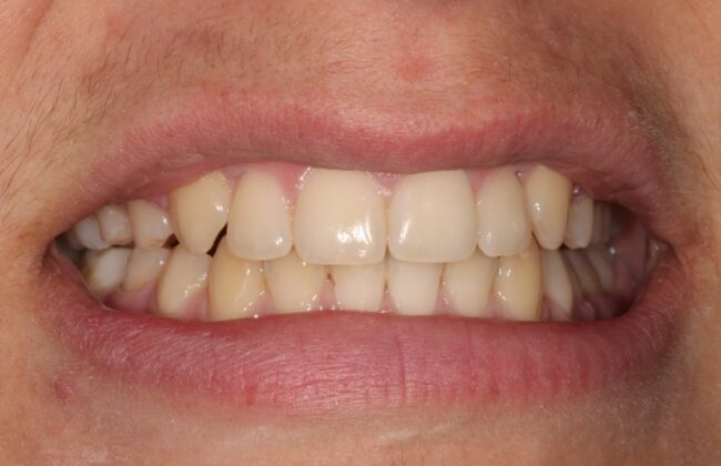 After