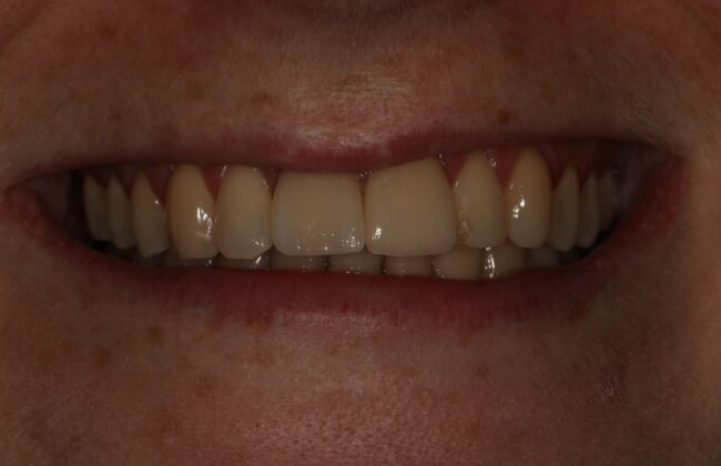 After