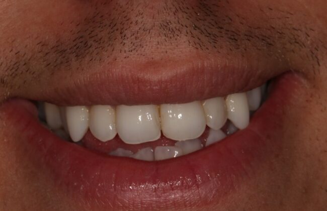 After