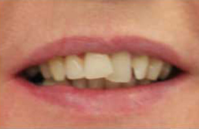 Before
