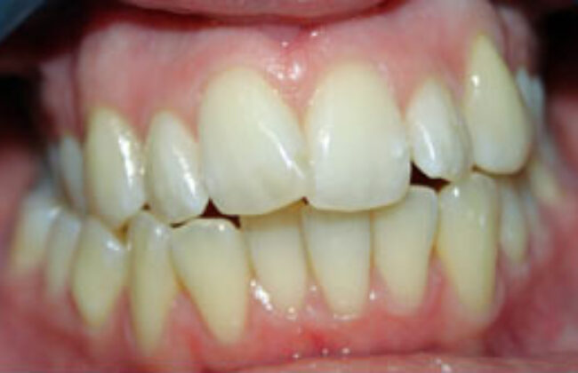 Before