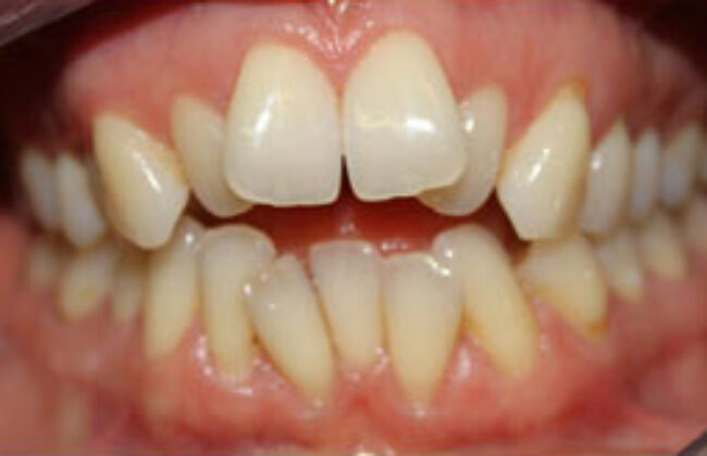 Before