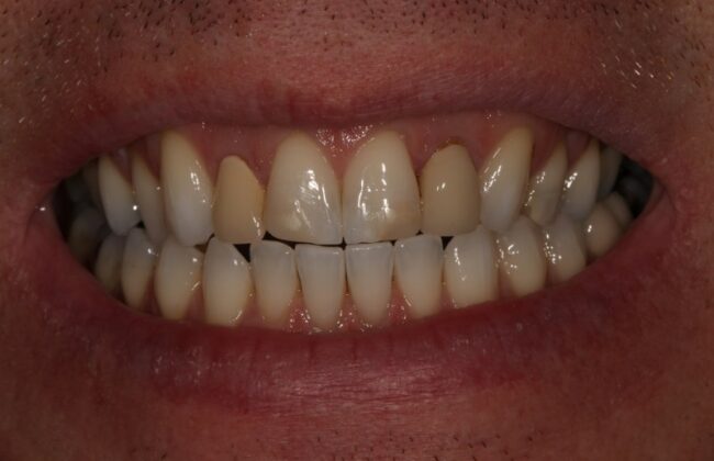 Before