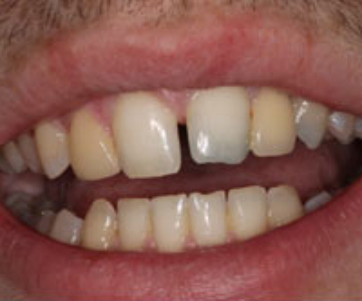 Practice Gallery Image -Smile Society