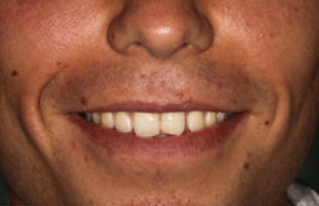 Before